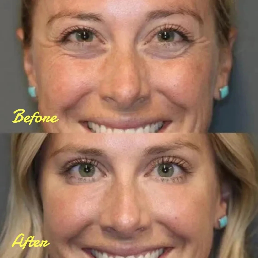 StellarGlow™ Face Tightener