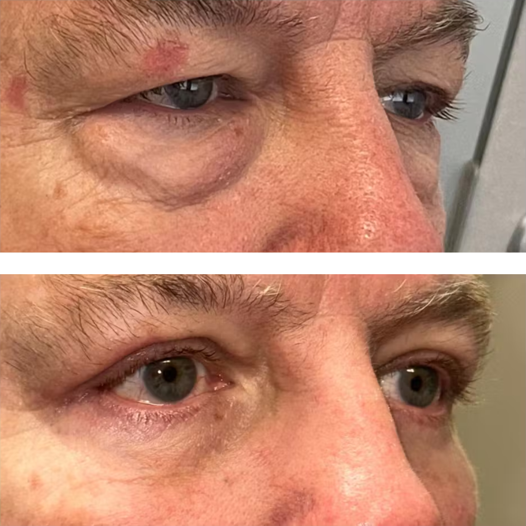 StellarGlow™ Face Tightener