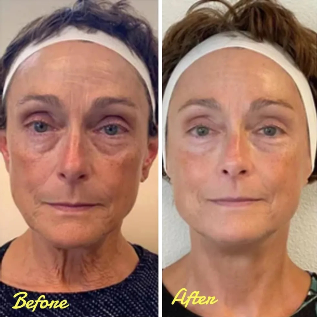 StellarGlow™ Face Tightener
