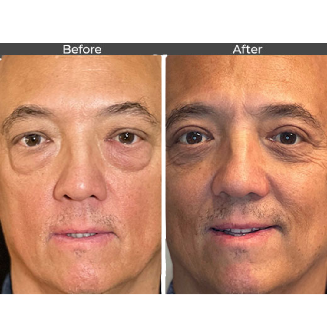 Unlock Radiant, Youthful Skin with StellarGlow's Face Tightener Serum