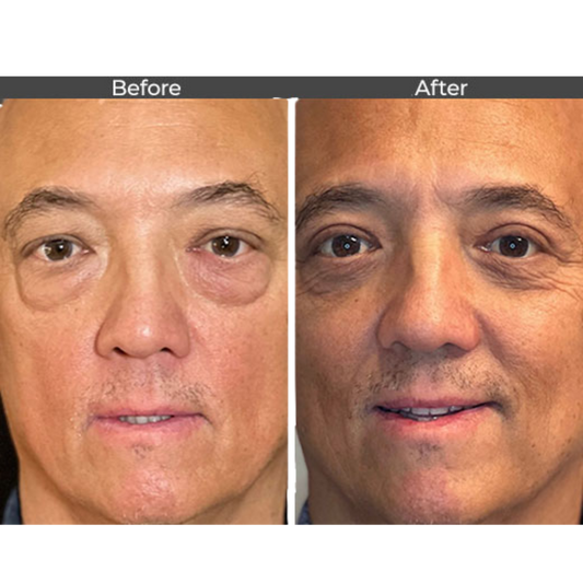 Unlock Radiant, Youthful Skin with StellarGlow's Face Tightener Serum