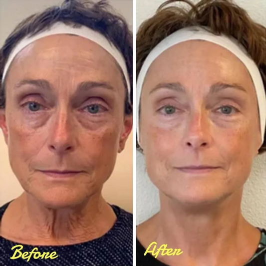 Reveal Your Glow: StellarGlow's Face Tightening Serum