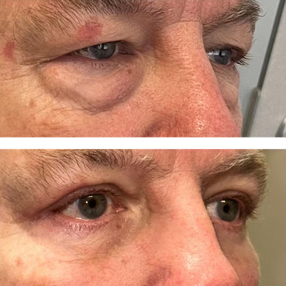 StellarGlow™ Face Tightener